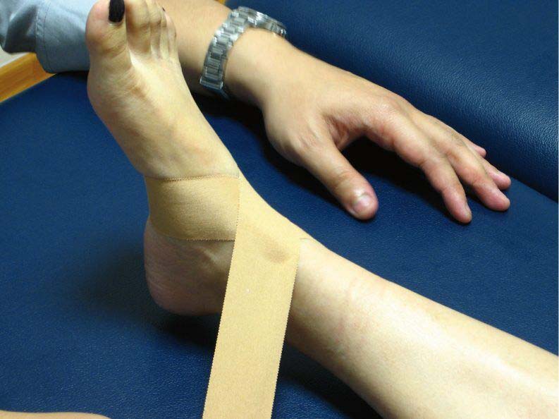 Image of a person's ankle being worn with a tape
