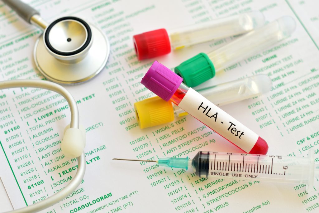 Human leukocyte antigen (HLA) blood sample.