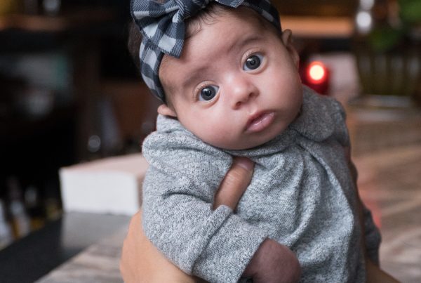 Adorable baby with head tilted to the side possibly because of torticollis.
