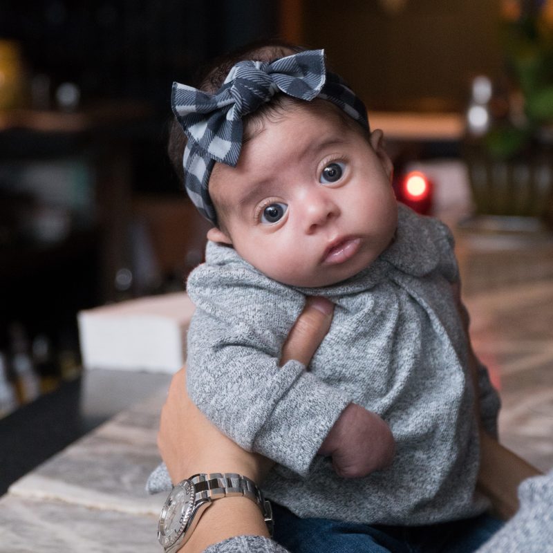 Adorable baby with head tilted to the side possibly because of torticollis.