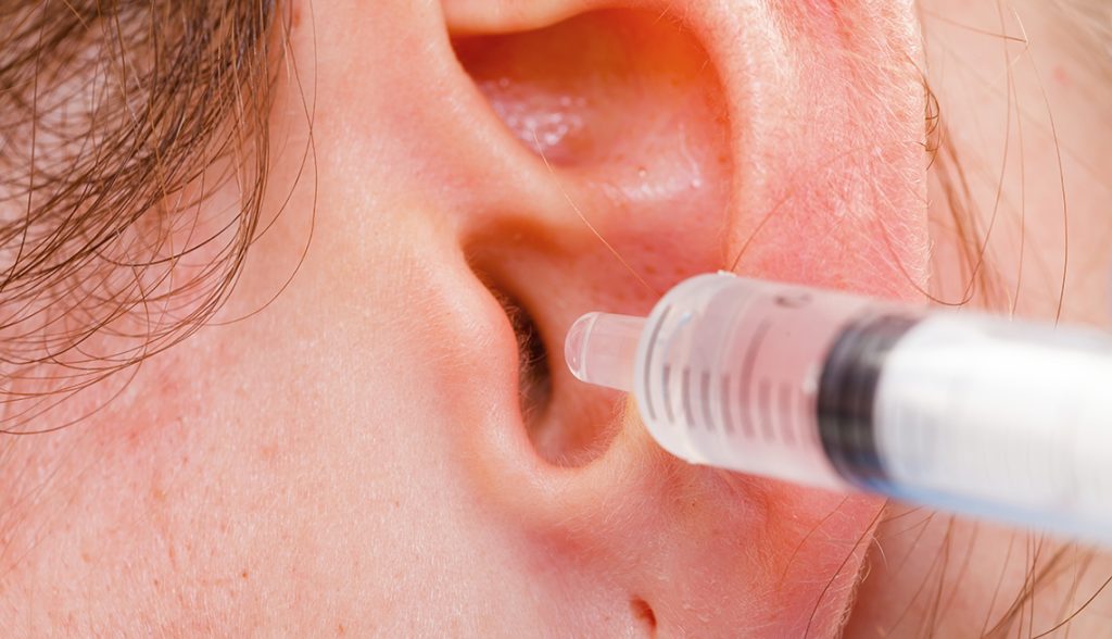 An ear is getting a couple drops of paraffin wax through a syringe to remove excess earwax