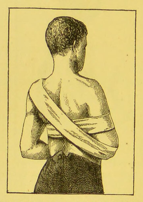 a drawing of a man with several layers of bandages on yellowish paper