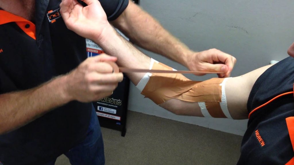 A person is strapping another person's elbow with several types of tape, using the the cricket taping method called collateral X taping