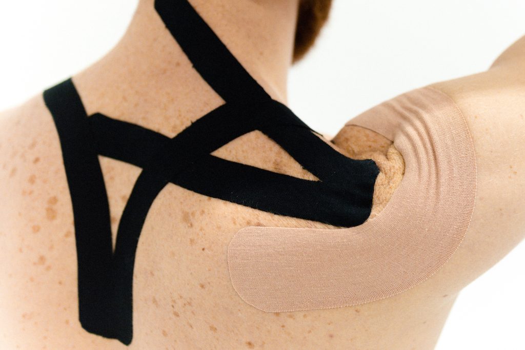 A patient is wearing black and beige KT tape, crisscrossing on their back, neck, and arm while in front of a white backdrop