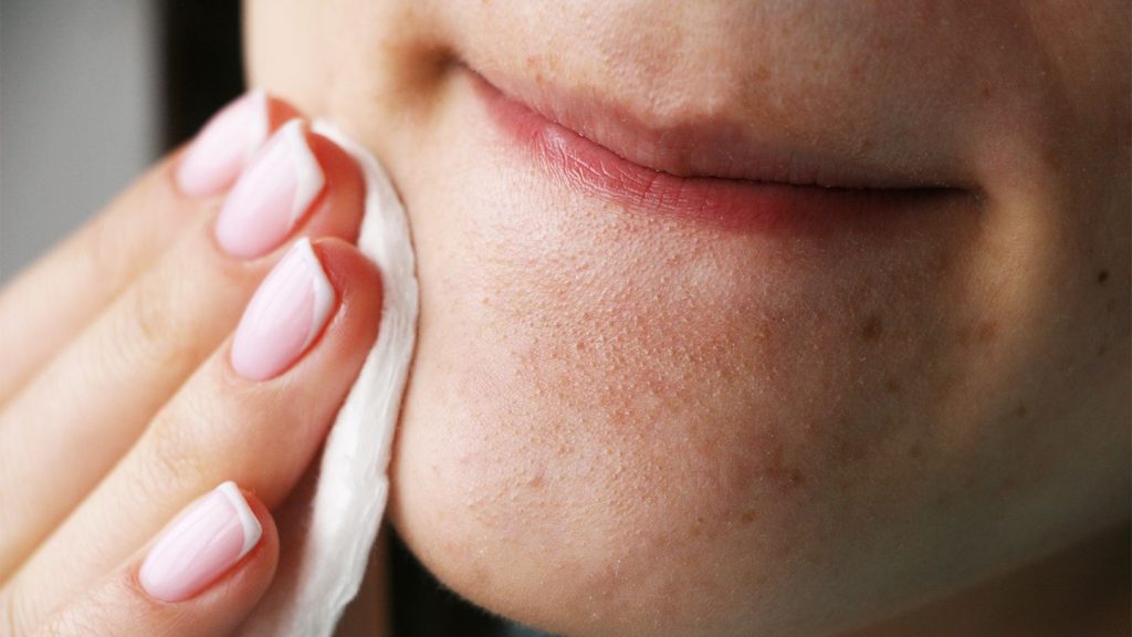 A person is putting on a solution of Epsom salt on their chin with a small cloth