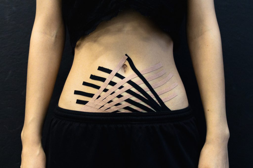 A person has black and beige kinesio tape on their stomach while wearing a short black top and black shorts 