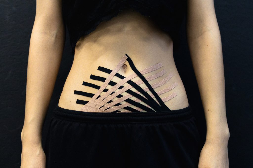A person has black and beige kinesio tape on their stomach while wearing a short black top and black shorts