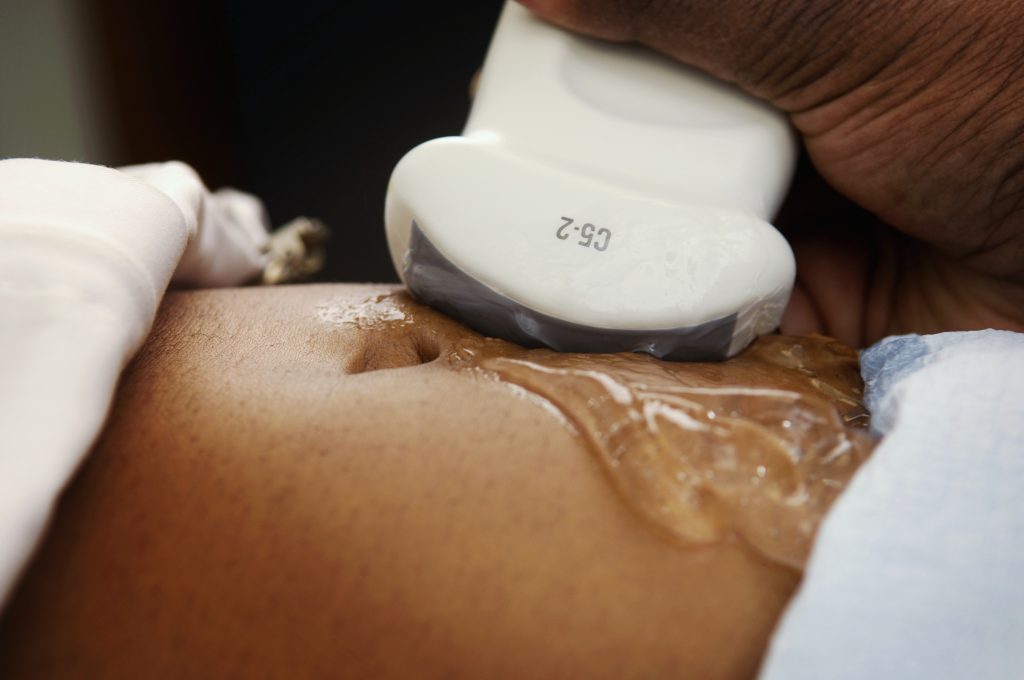 It's a close up of ultrasound gel and a transducer on the stomach of a patient in front of a black background