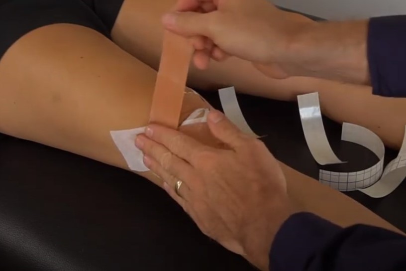 A patient wearing black shorts while lying down on a brown physiotherapist bed is having their knee taped up with rigid tape by a skilled physiotherapist