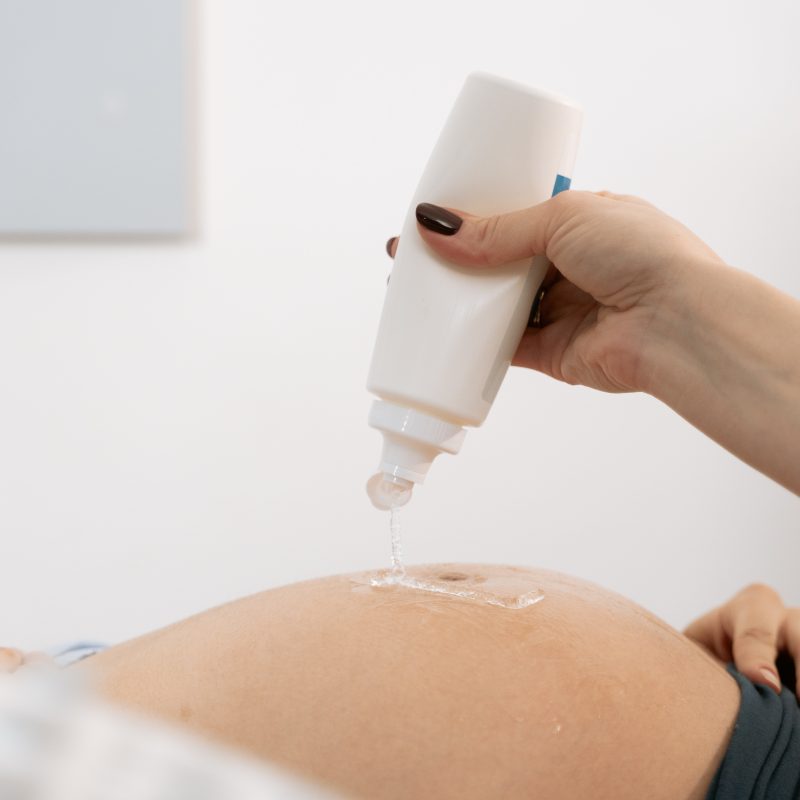 A medical professional is squirting on ultrasound gel using a white bottle on the belly of a patient