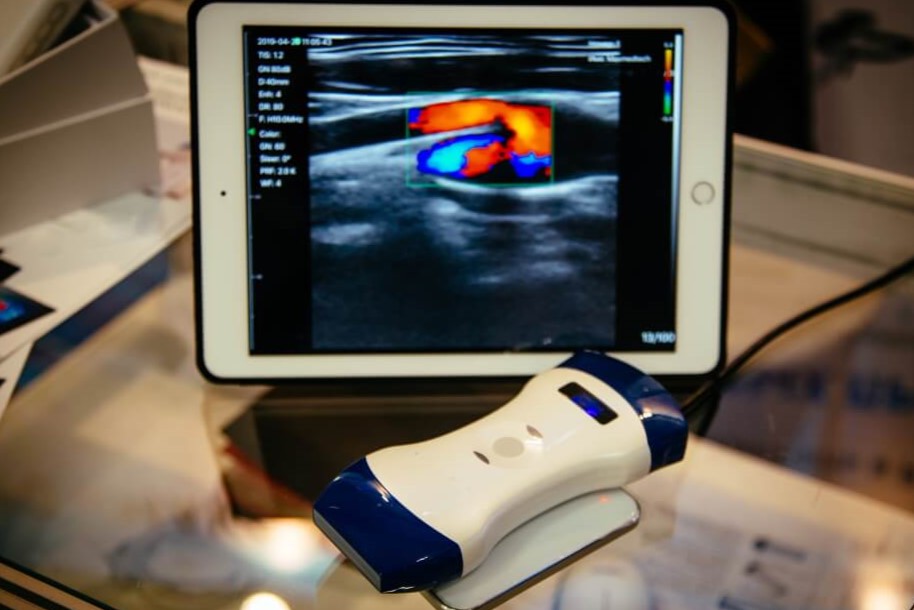 A portable ultrasound machine is placed on a clear glass table