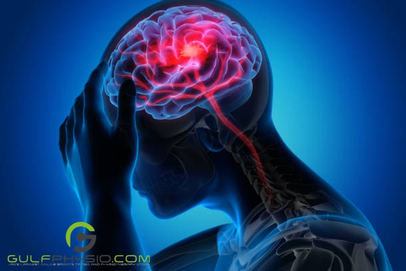 A visual representation of damaged brain function.