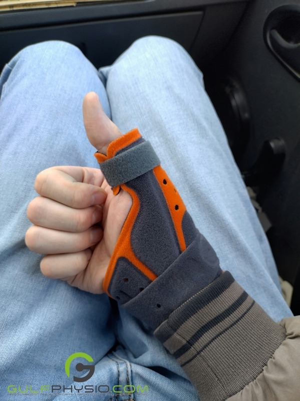 A photo of an injured hand in a wrist brace. It is giving a “thumbs up”.